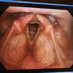 OK, it's not a gyno team. It's my throat, vocal chords and larynx